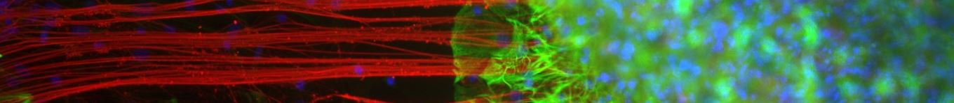 www.optineurin-neuroimmunology.uniri.hr